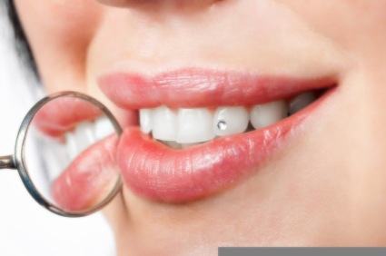 Improve Your Smile with Dental Veneers!